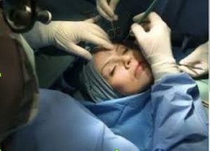Mulher procedimento cirúrgico facial